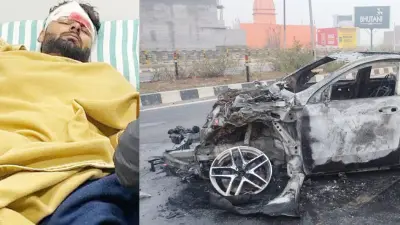 Rishabh Pant Accident: प्लास्टिक सर्जरी के लिए ऋषभ पंत को एयरलिफ्ट किया जा सकता है दिल्ली