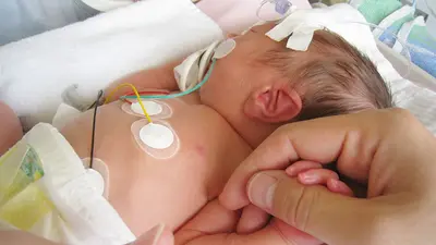 Congenital Heart Disease: जन्मजात दिल की बीमारी से ग्रसित बच्चों का नि:शुल्क ऑपरेशन कराएगी UP सरकार, MOU साइन