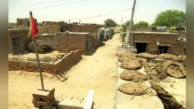 बड़े और फूले होंठ के लिए कराएं Lip Flip, जानें इसके बारे में सबकुछ