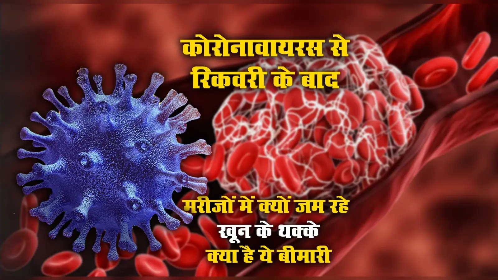 Covid Symptoms: क्यों कोविड के दौरान या रिकवरी के बाद मरीजों में जम रहे खून के थक्के, क्या है थ्रोम्बोसिस बीमारी, जानें कारण, लक्षण व उपचार