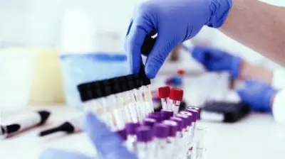 गढ़वा जिले में नर्स व समाहरणालय के दो कर्मी संक्रमित