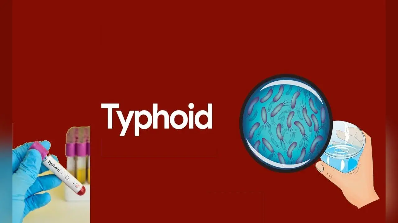 Typhoid Fever: टाइफाइड बुखार हुआ और घातक, एंटीबायोटिक के खिलाफ प्रतिरोधी हुए बैक्टीरिया