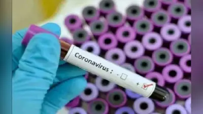 Delhi Corona News: दिल्ली में कोरोना के सामने आए 729 नए केस, मंकीपॉक्स से संक्रमित व्यक्ति की हालत स्थिर