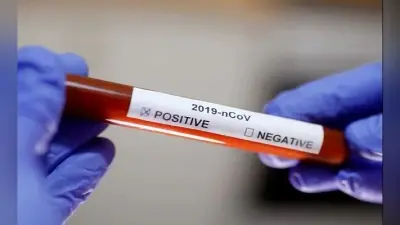 Coronavirus in Bihar : डिप्टी सीएम सुशील मोदी के कार्यालय के 4 कर्मी कोरोना पॉजिटिव, दफ्तर बंद