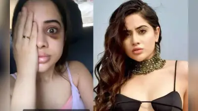 उर्फी जावेद को किसने पीटा? आंख के नीचे काले निशान देख फैंस हुए परेशान, वायरल हो रही ये तसवीर