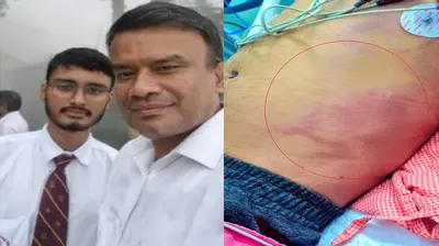 पापा मुझे ले चलो…सुजीत मुझे कैमरा बंद कर बहुत पीटता है… एसडीएम के बेटे की पीट-पीट कर हत्या