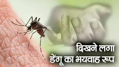UP News : गाजियाबाद में डेंगू के मामले बढ़कर 1,245 हो गए, एक दशक में पहली बार इतने मरीज