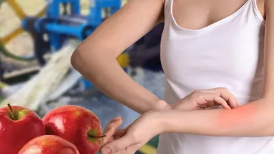 Winter Season Skin Care Tips: Moisturizer गुणों से भरपूर इन फूड एंड ड्रिंक्स का करें सेवन और सर्दी में Dry Skin की खुजली और Rashes से पाएं छूटकारा