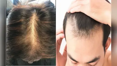 Hair Care Tips: 40 की उम्र के बाद महिला और पुरुषों के क्यों झड़ते हैं बाल, ऐसे करें देखभाल