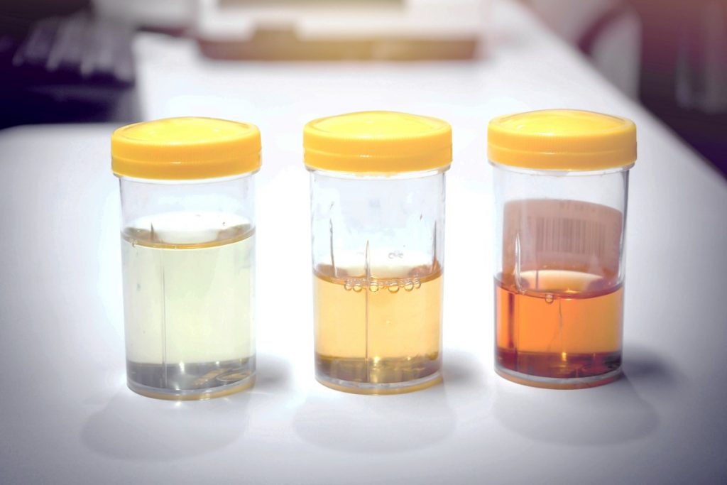 urine