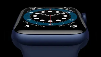COOL दिखने के लिए बंदे ने खरीदी Apple Watch, इसके अलर्ट ने बचायी जान