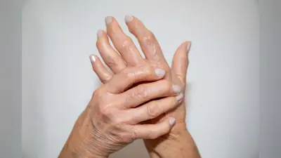 Arthritis reason:महिलाओं में आर्थराइटिस की वजह