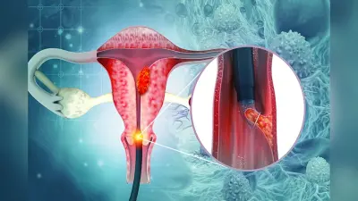 HPV Vaccine लगवाएं और शरीर के इन अंगों की करें कैंसर से रक्षा, एक्सपर्ट से जानें