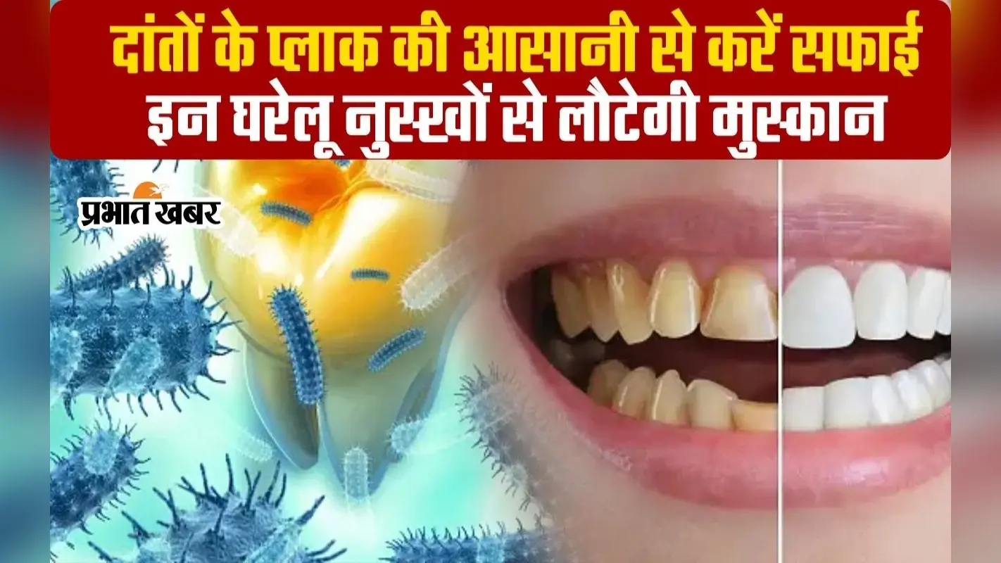 VIDEO: दांतों की सफाई को ना करें इग्नोर,प्लाक हटाकर लौटाएं प्यारी मुस्कान, आजमाएं ये उपाय
