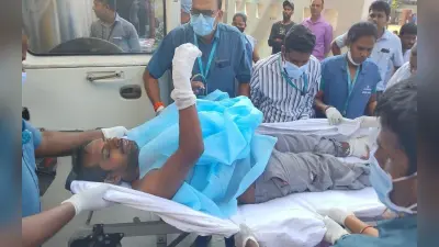 विशाखापत्तनम: स्टील मेल्टिंग प्लांट में बड़ा हादसा, लोहे के गोले में विस्फोट से 10 लोग घायल, अस्पताल में भर्ती