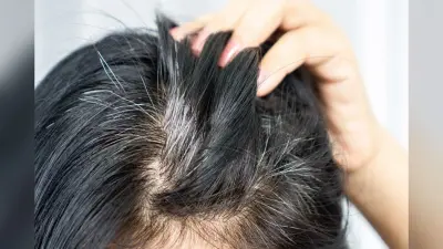 Home Remedies For White Hair: सफेद बालों को नेचुरल तरीके से कैसे करें काला, यहां जानें घरेलू उपाय