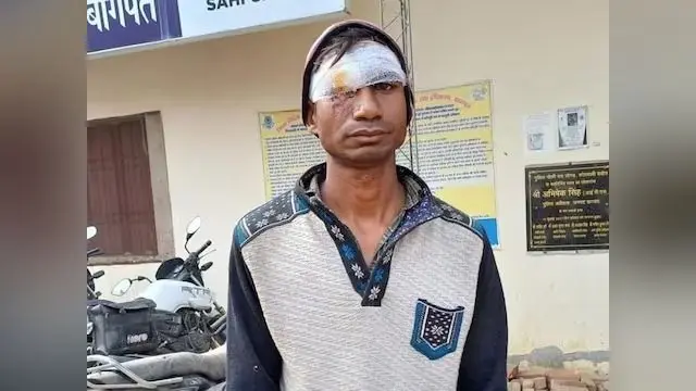 UP News: पति ने नहीं दिया गाने सुनने के लिए मोबाइल, तो पत्नी ने आंख में घोंप दी कैंची, जानें पूरा मामला