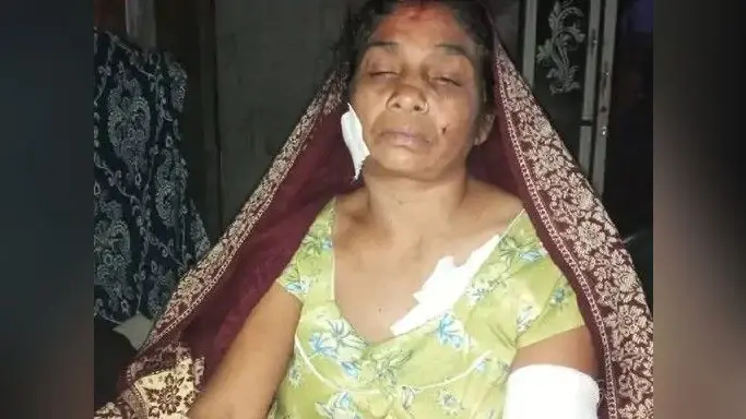 Lucknow News: बेरहम पति ने पत्नी को बीच सड़क पर 12 सेकेंड में 17 बार कैंची से गोदा, आरोपी गिरफ्तार
