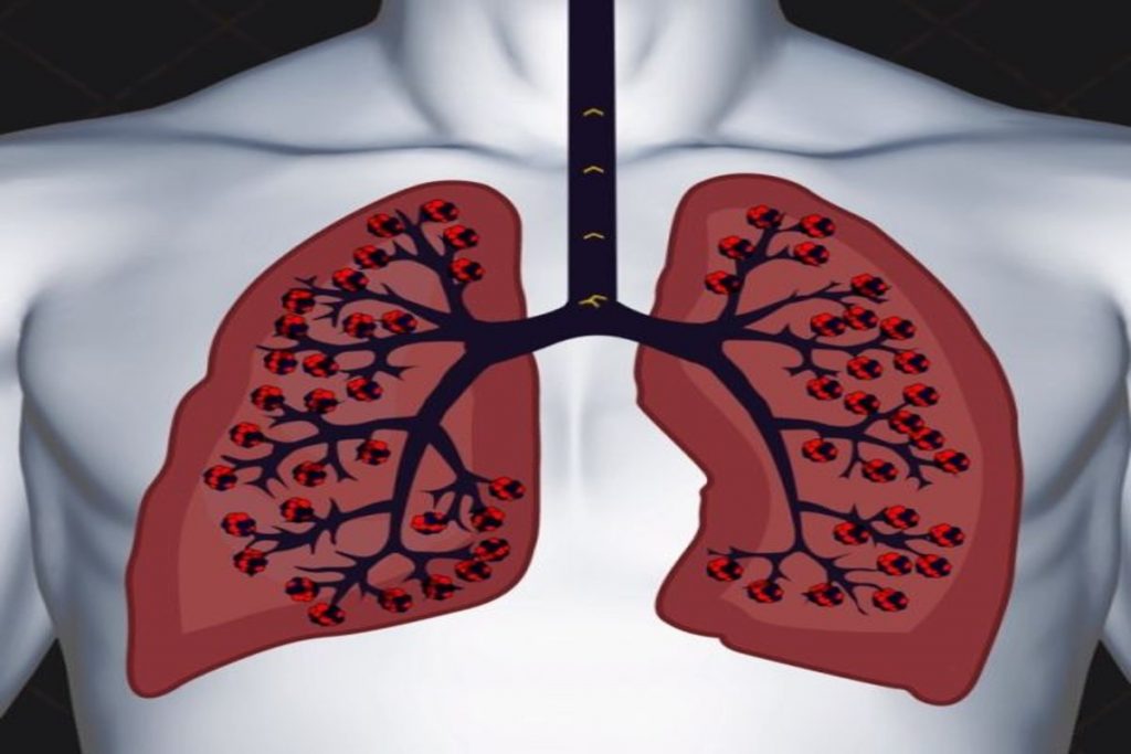 lungs