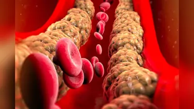 Morning Habits For Cholesterol: बढ़ते कोलेस्ट्रॉल लेवल से निजात पाना चाहते हैं, एक महीने तक सुबह में करें ये काम