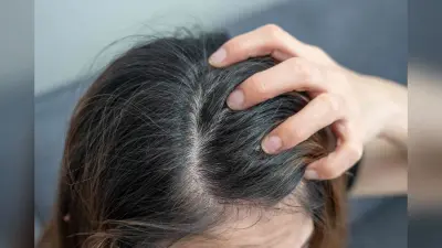 Itchy Scalp Problem: गर्मी के मौसम में बालों में खुजली से हैं परेशान, तो ये हैं आप के लिए कुछ आसान उपाय
