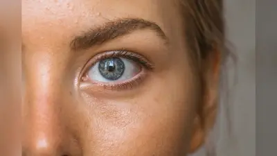 Summer Skin Care Tips: सनबर्न से होने वाले नुकसान से खुद को रखें सुरक्षित, जानें क्या है तरीका
