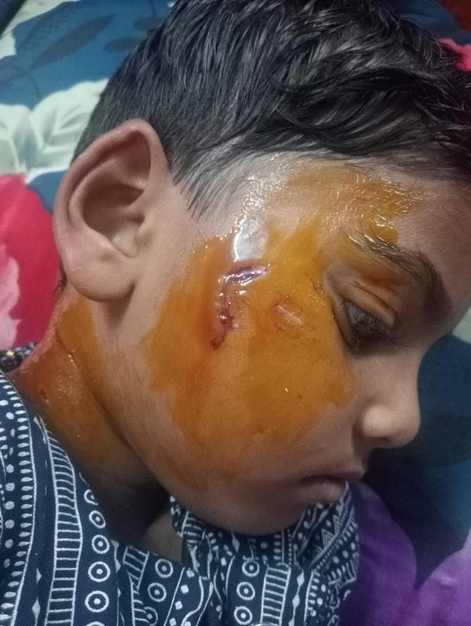 जीएम कॉलोनी ढोरी में बंदरों के आतंक से लोग परेशान