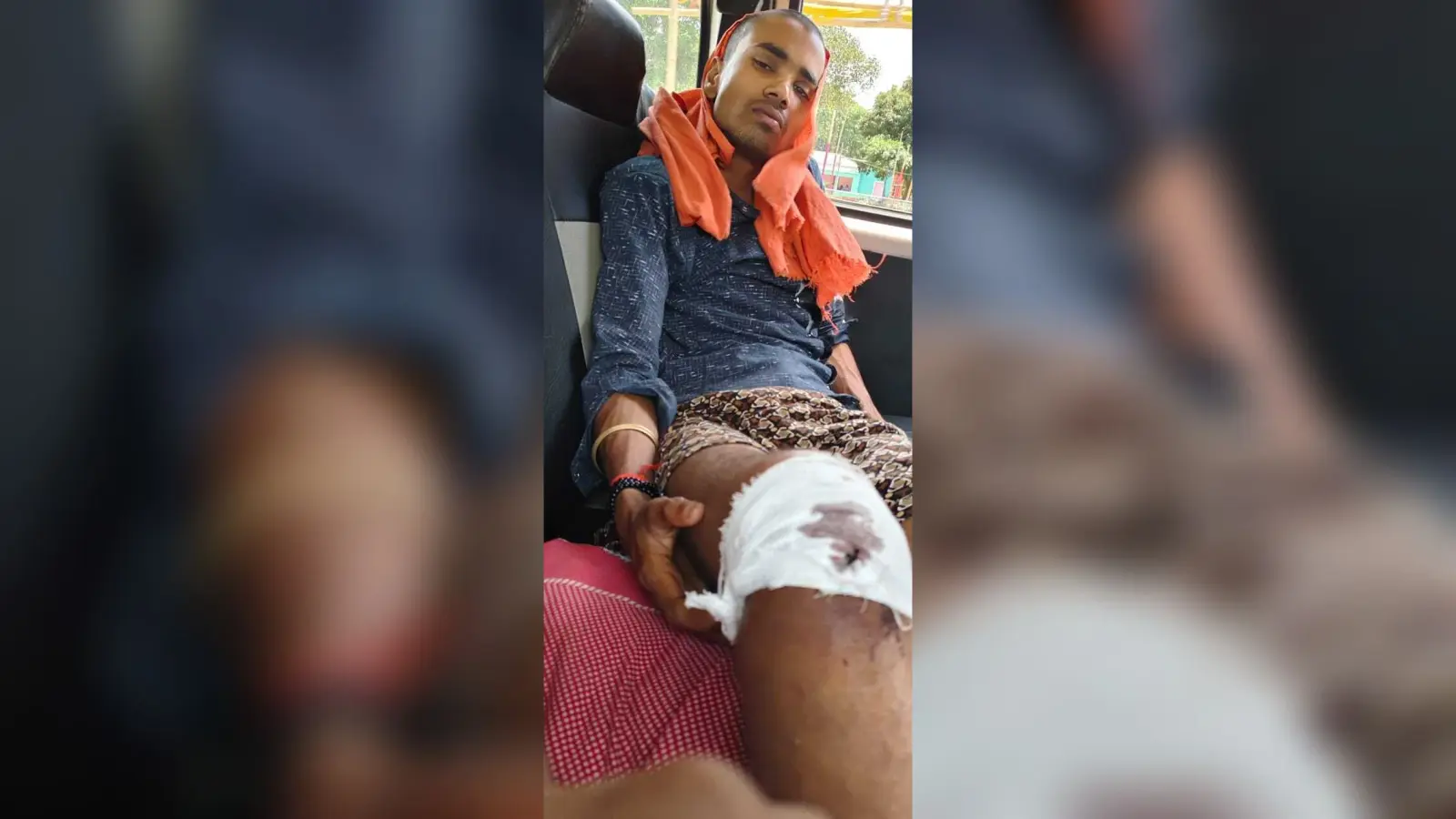ऑटो व बाइक की टक्कर में एक युवक जख्मी