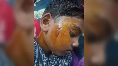 जीएम कॉलोनी ढोरी में बंदरों के आतंक से लोग परेशान