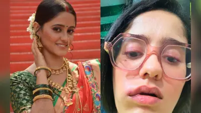 Ghum Hai Kisikey Pyaar Meiin की ‘सई’ आयशा सिंह के चेहरे का हुआ बुरा हाल, तसवीर शेयर कर बोलीं- प्रार्थना करें