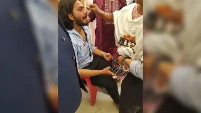 डीएसपीएमयू : छात्रों के बीच जम कर हुई मारपीट, एक का माथा फटा, तीन टांके लगे