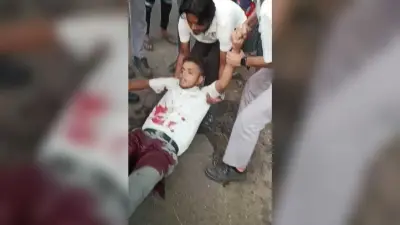 बर्मामाइंस : सांड के हमले से एनटीटीएफ के छात्र जख्मी