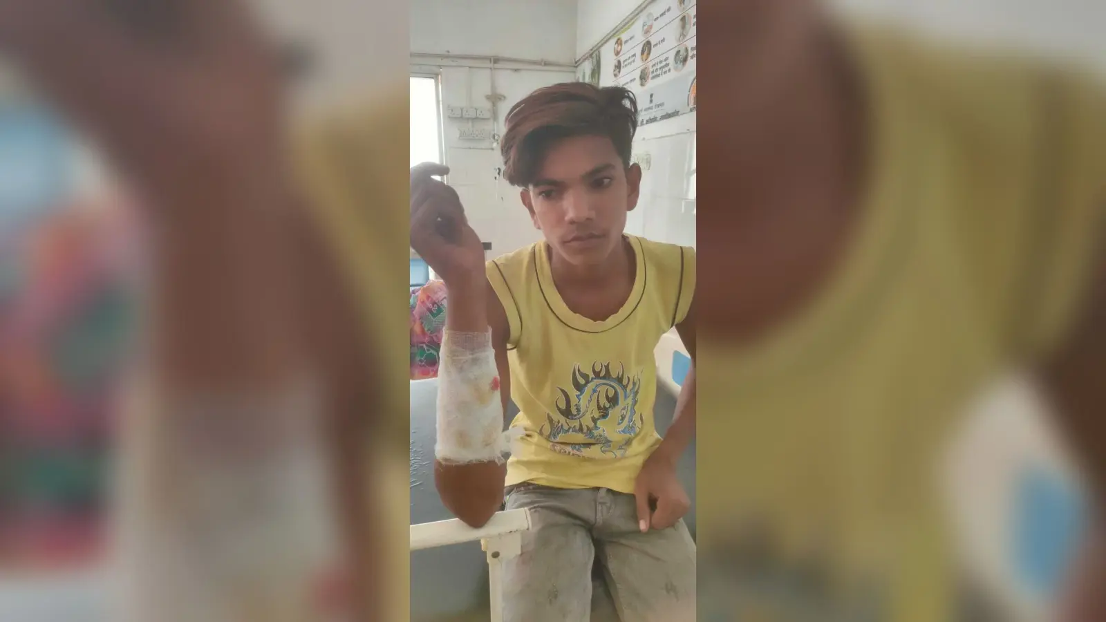 दातुन तोड़ने गये युवक पर जंगली सुअर ने किया हमला, घायल