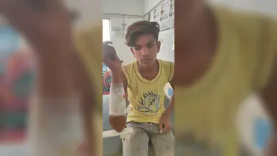 दातुन तोड़ने गये युवक पर जंगली सुअर ने किया हमला, घायल