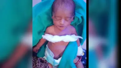 चार घंटे के जटिल ऑपरेशन के बाद बचायी नवजात की जान
