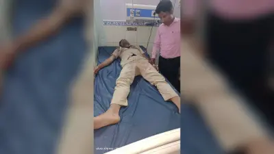 उत्पाद पुलिस टीम पर हमला, होमगार्ड जवान घायल