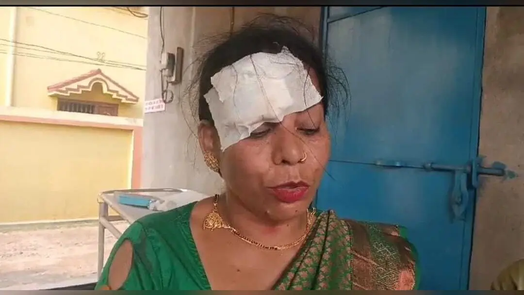 कार व ऑटो में टक्कर, कुल्टी के पांच घायल
