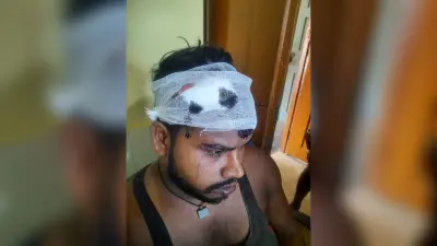 बड़े भाई ने छोटे पर किया भुजाली से हमला, हालत गंभीर
