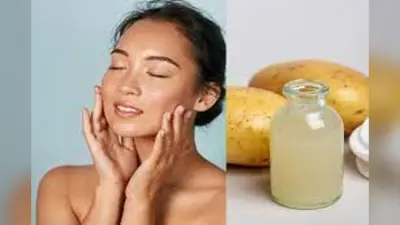 Skincare Tips: चेहरे पर आलू का रस लगाने के फायदे, ब्यूटी एक्सपर्ट से जानिए