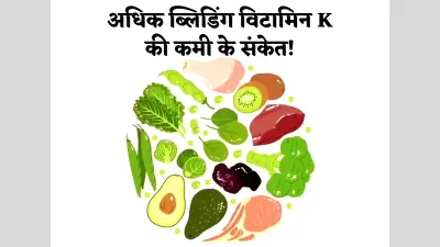 Vitamin K: ‘विटामिन के’ की कमी से हो सकते हैं कई रोग, अधिक ब्लीडिंग हो सकती है ‘विटामिन K’ की कमी के संकेत