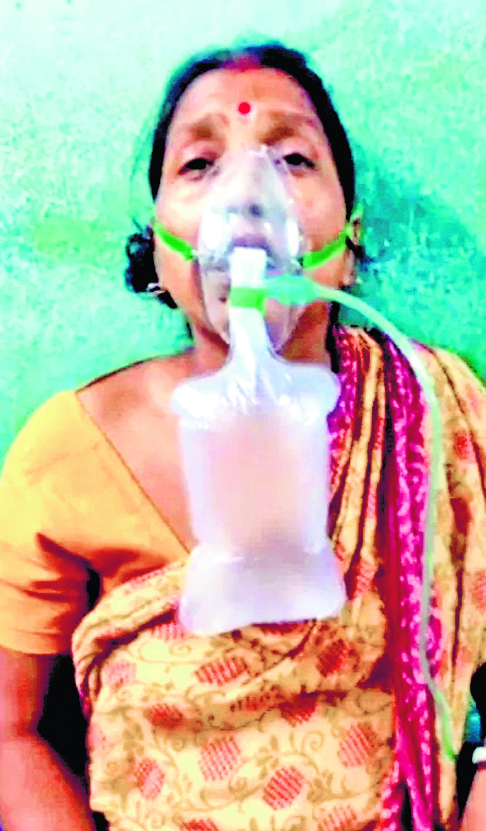कुलतली : सर्पदंश की शिकार महिला सांप को पकड़कर पहुंची अस्पताल