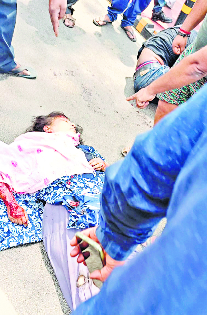 कार के धक्के से युवक का पैर कट कर रोड पर गिरा, महिला गंभीर