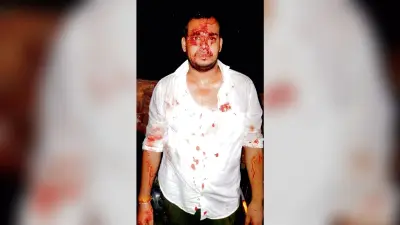 दासनगर में तृणमूल के दो गुट फिर आपस में भिड़े, दो लोग हुए घायल