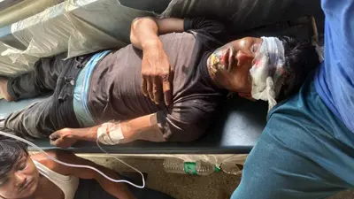 स्कार्पियो व बाइक की टक्कर, पिता-पुत्र जख्मी, इलाज के क्रम में पिता की हुई मौत, जिंदगी और मौत से जुझ रहा पुत्र