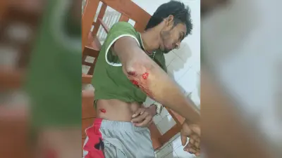 मारपीट का मामला दर्ज