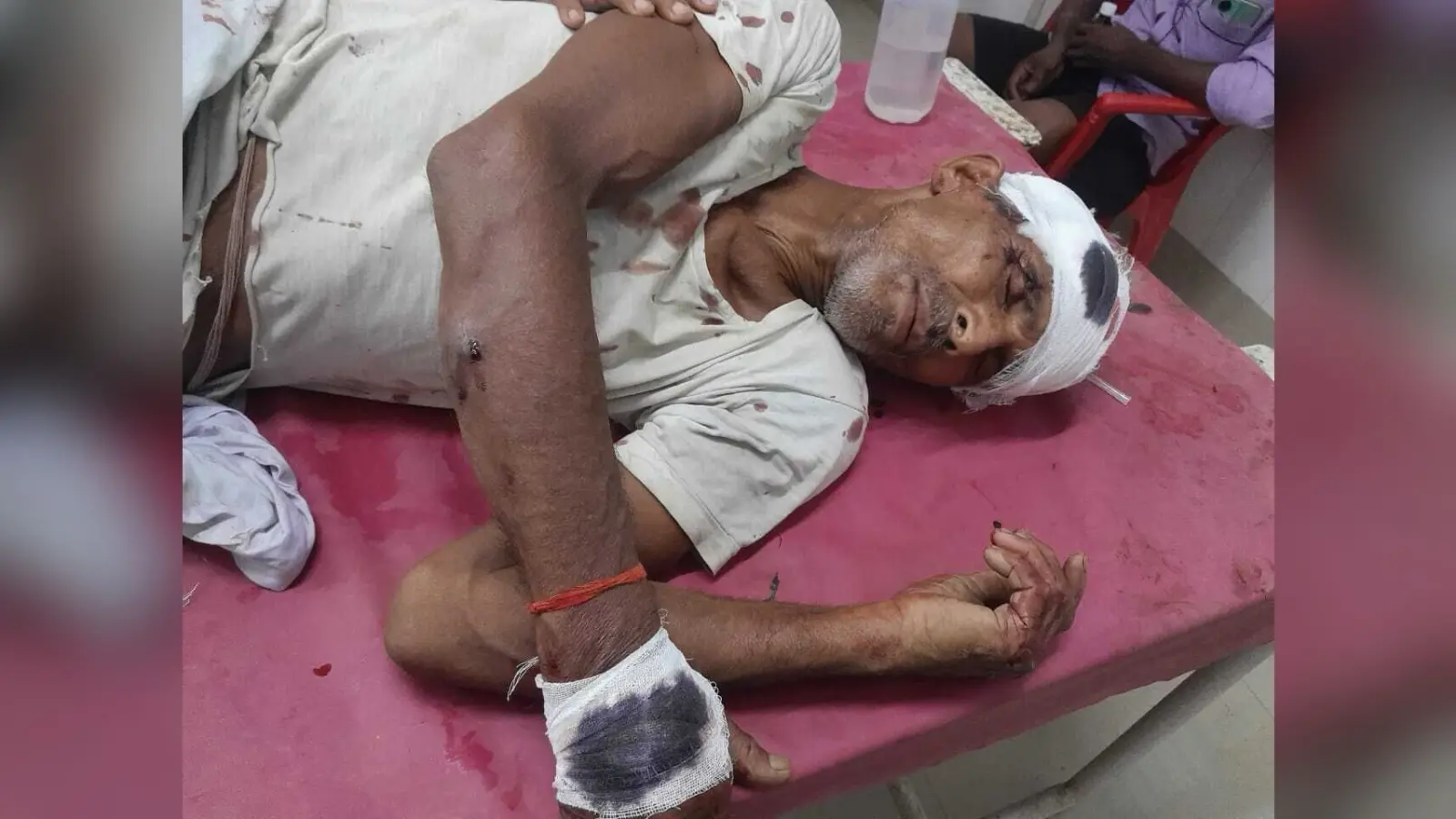 जमीन विवाद के कारण हुई हिंसक झड़प, बुजुर्ग समेत तीन जख्मी