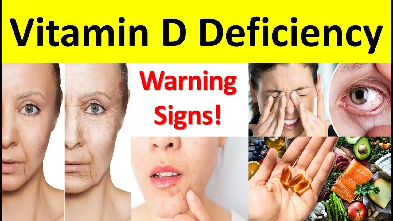 Vitamin D Deficiency: शरीर में विटामिन डी की कमी के हैं ये लक्षण, जरूर दें ध्यान