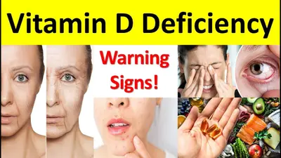 Vitamin D Deficiency: शरीर में विटामिन डी की कमी के हैं ये लक्षण, जरूर दें ध्यान