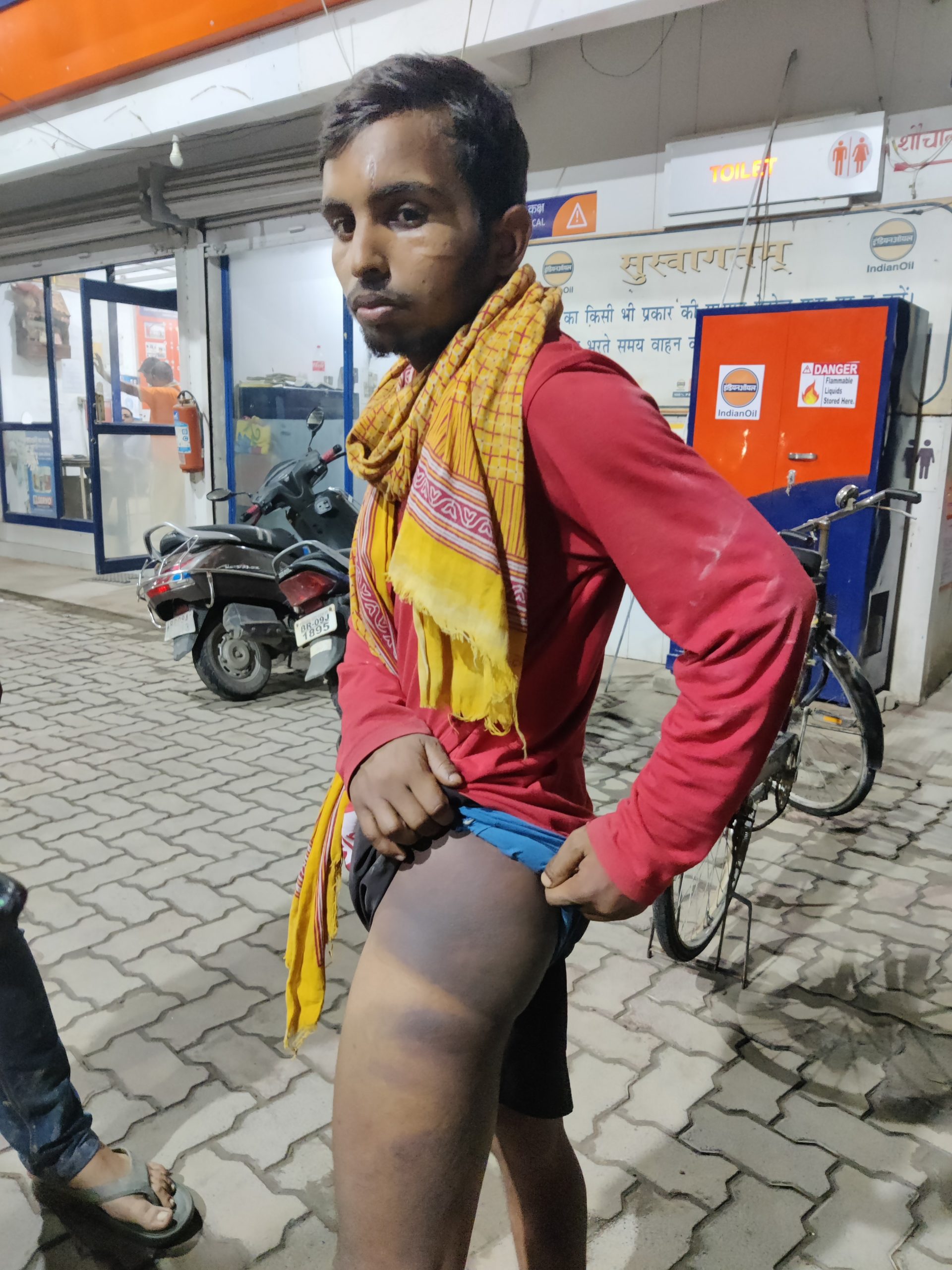 हथिदह थानाध्यक्ष पर नौकर को बंधक बना पिटाई का आरोप, निलंबित