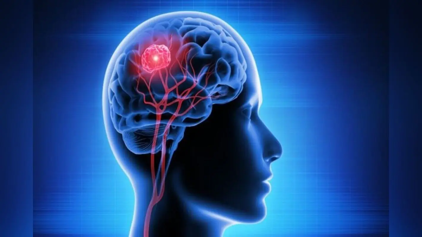 Brain TB का इलाज हो गया है आसान, क्या है भारतीय वैज्ञानिकों की नई खोज?